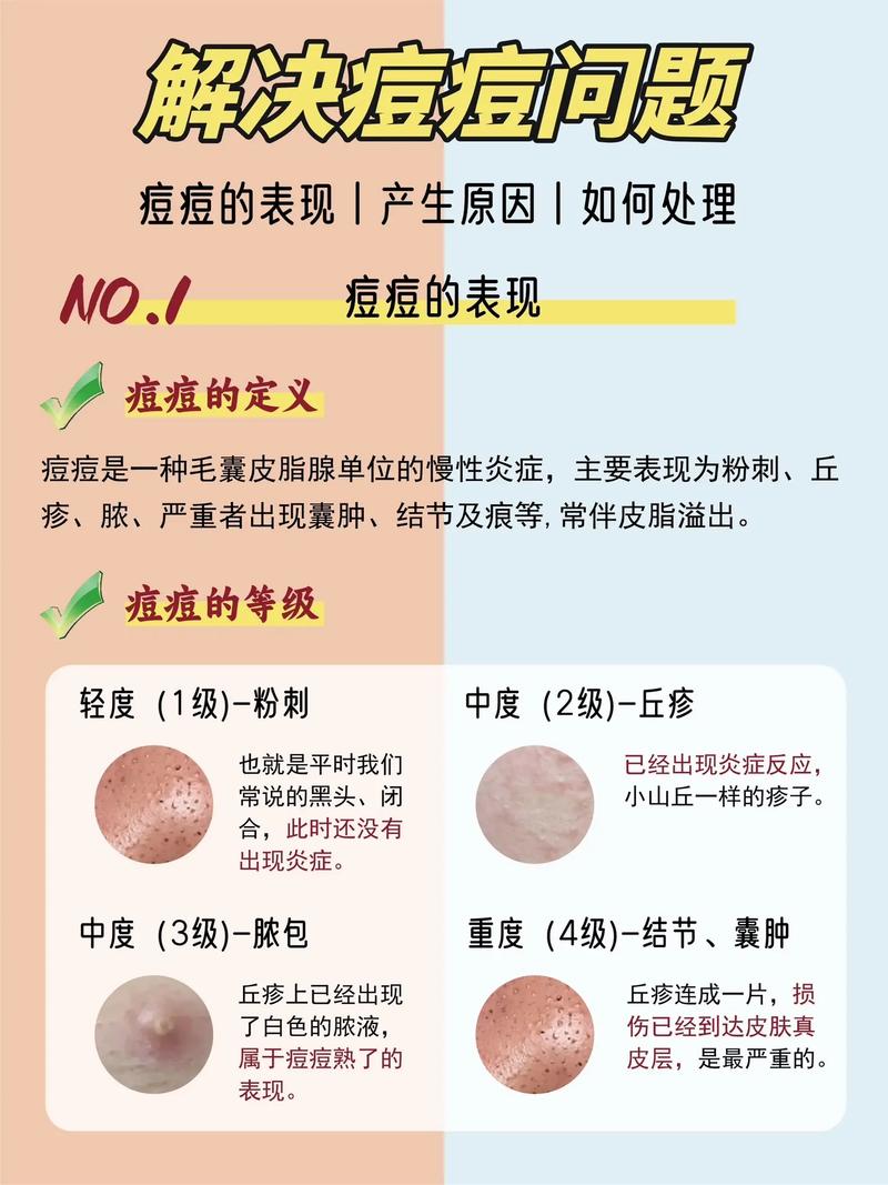 微视合集如何制作?合集类型有哪些?