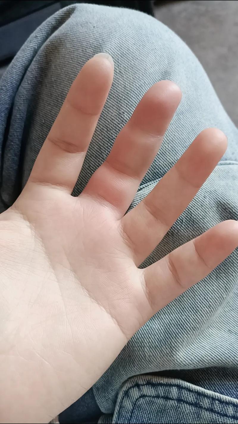 刷抖音手肿了什么原因