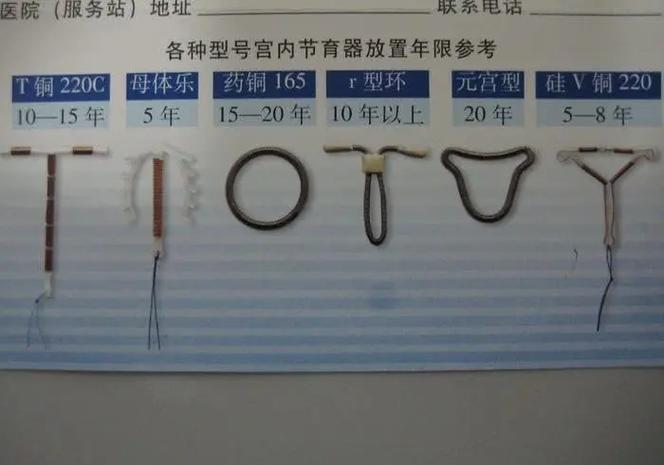 抖音为什么不能上环了呢