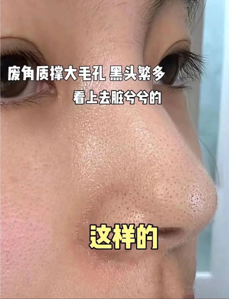 黑头在抖音是什么意思啊