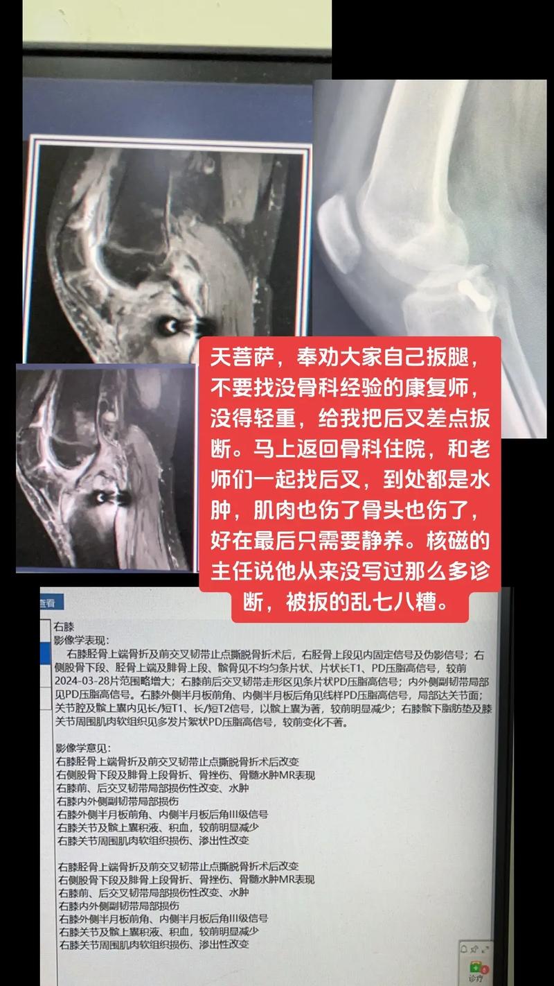 抖音腿断是什么意思呀