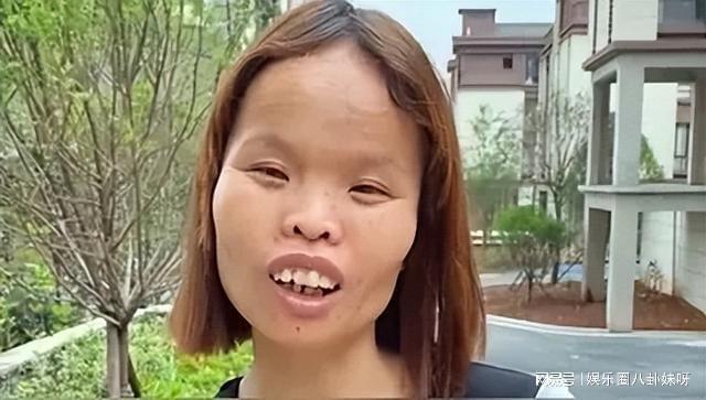 抖音最火很丑的人叫什么