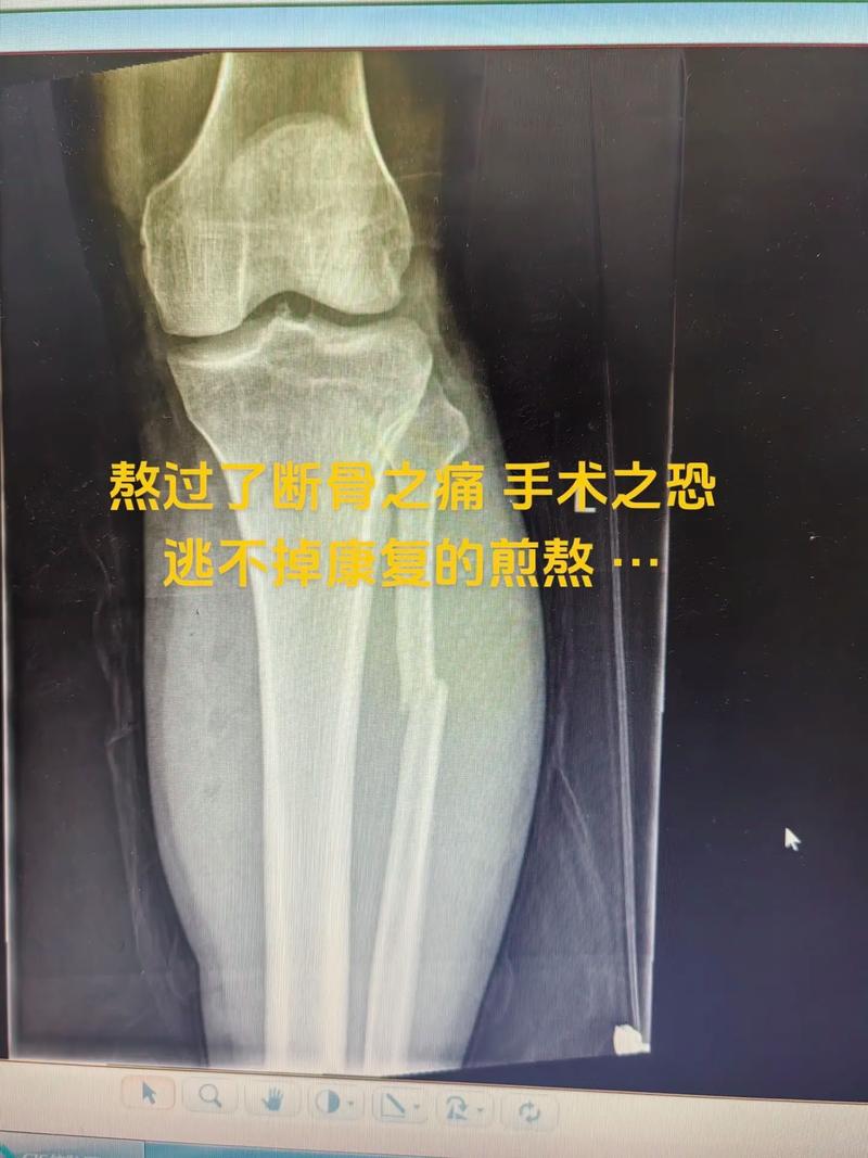 抖音腿断是什么意思呀