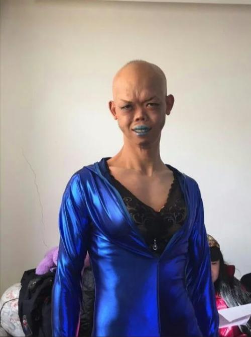 抖音最火很丑的人叫什么