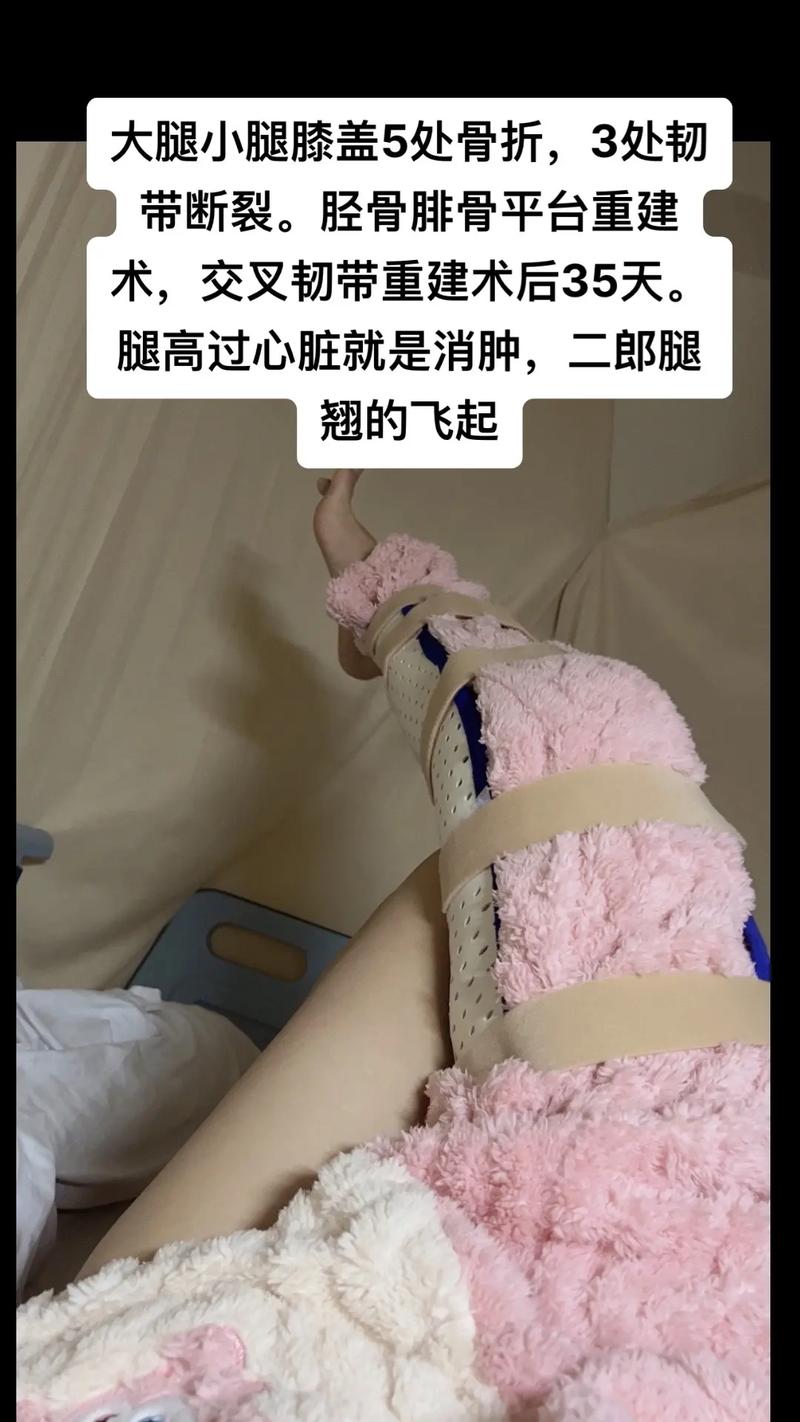 抖音腿断是什么意思呀
