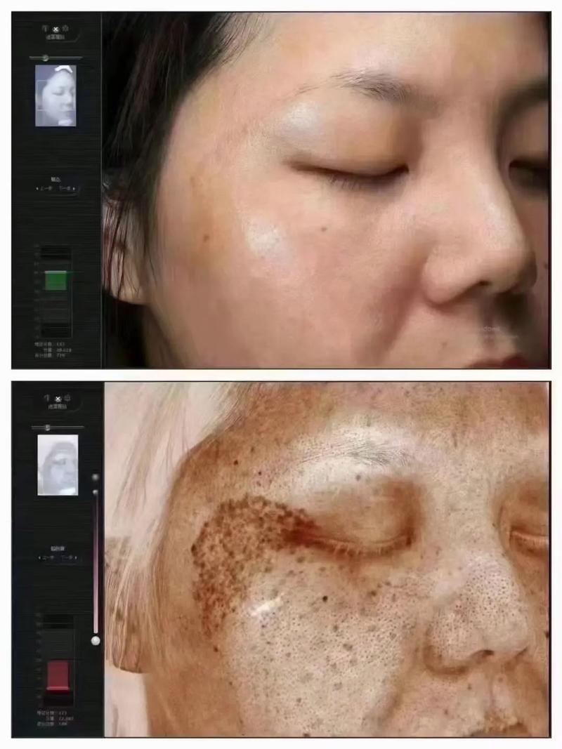 为什么拍抖音的皮肤偏红