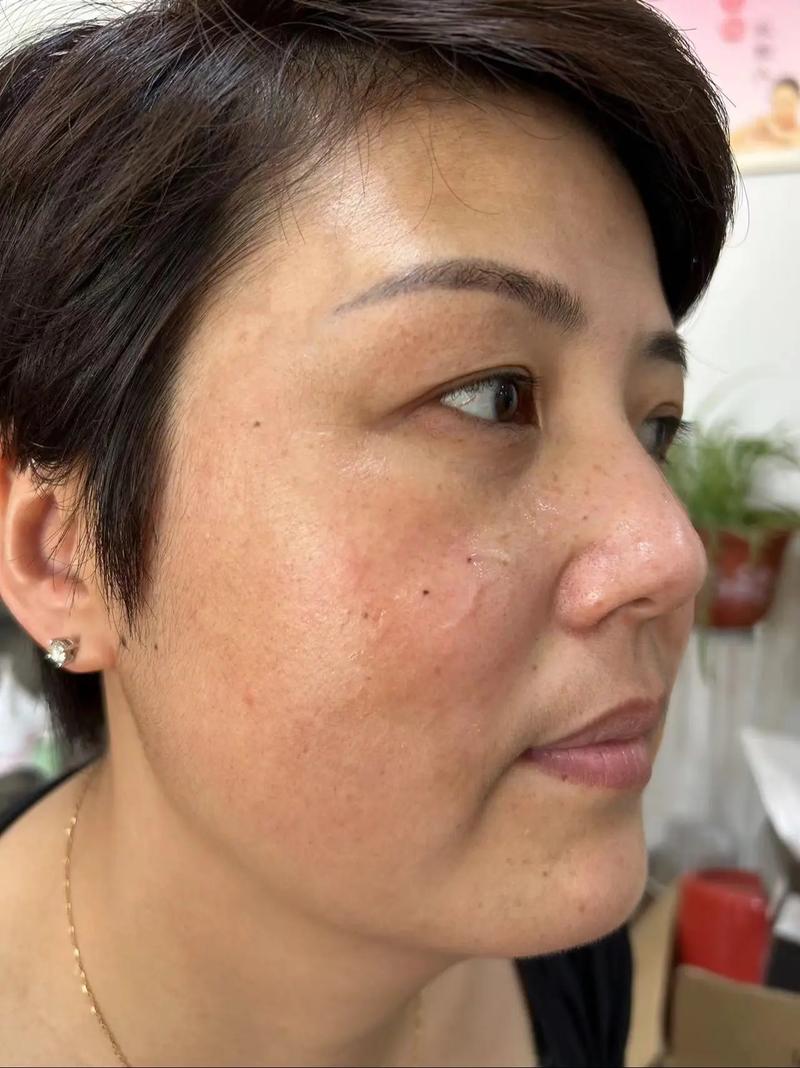 为什么拍抖音的皮肤偏红