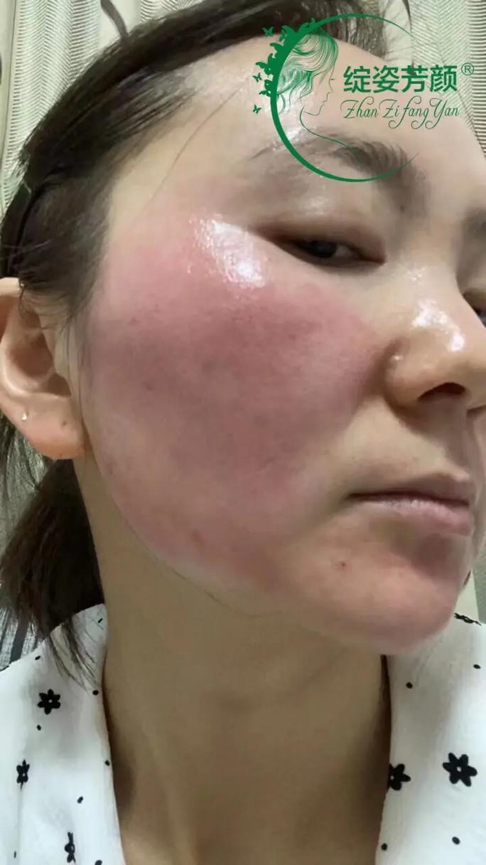 为什么拍抖音的皮肤偏红