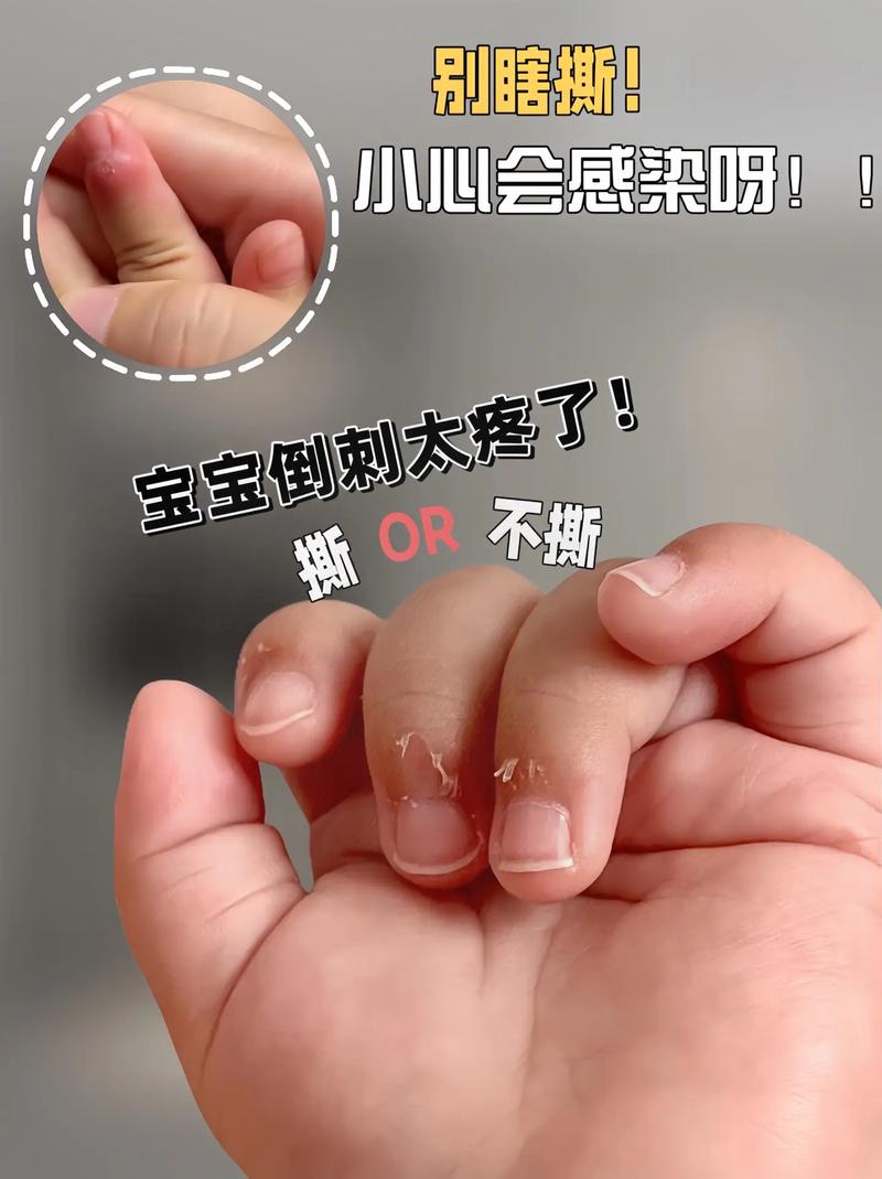 刷抖音手肿了什么原因