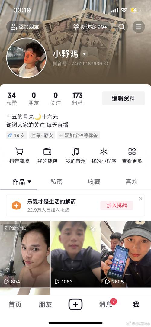 抖音置顶用什么样的好