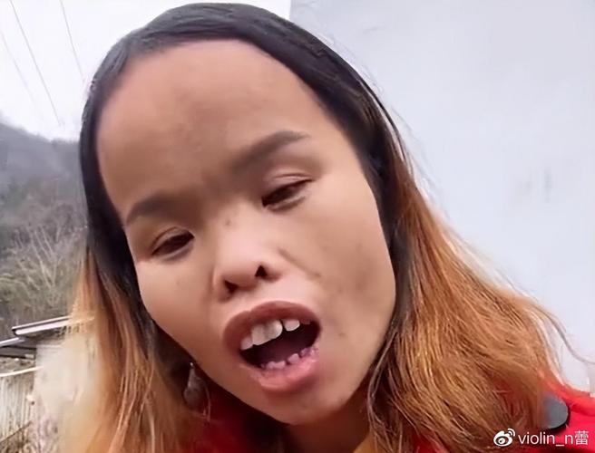 抖音最火很丑的人叫什么
