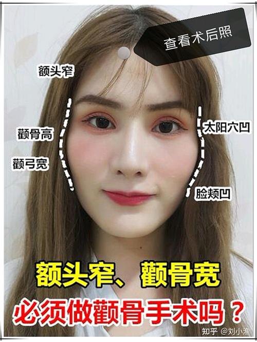 额头太窄如何办宽带?