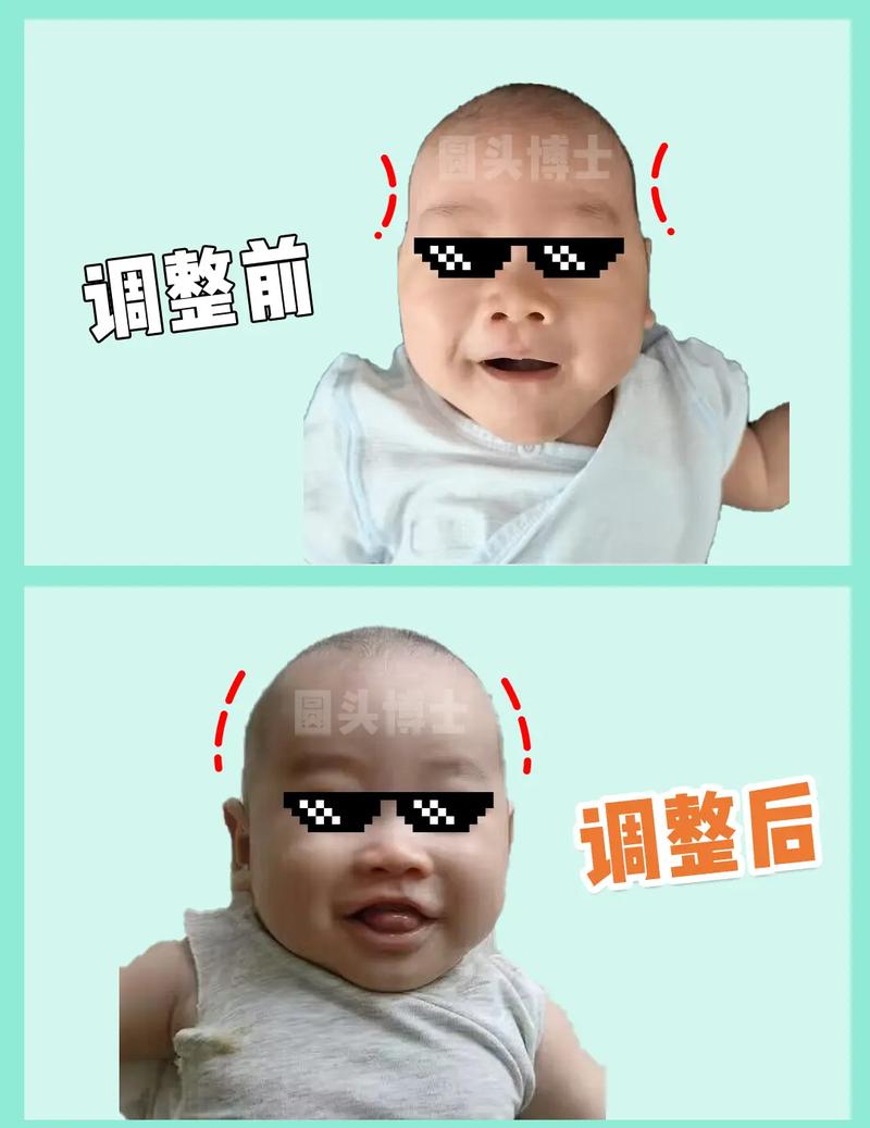 额头太窄如何办宽带?