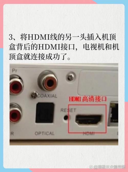 如何用宽带连接电视?