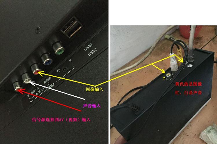宽带电视机顶盒如何设置连接?
