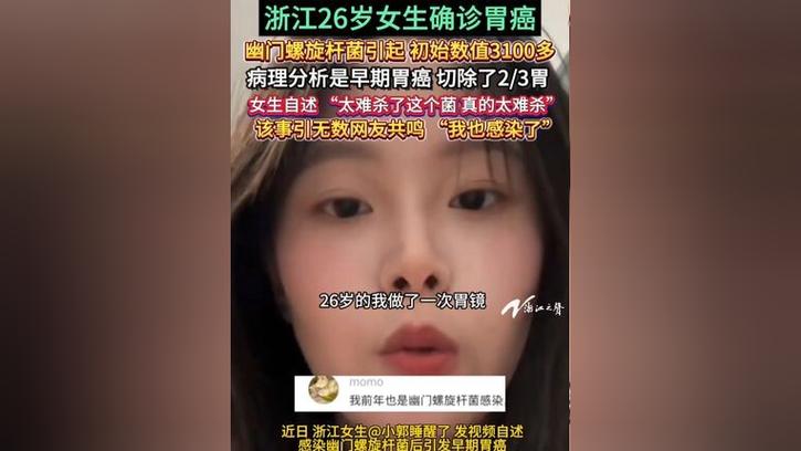 26岁女生患胃癌:疑因幽门螺旋杆菌