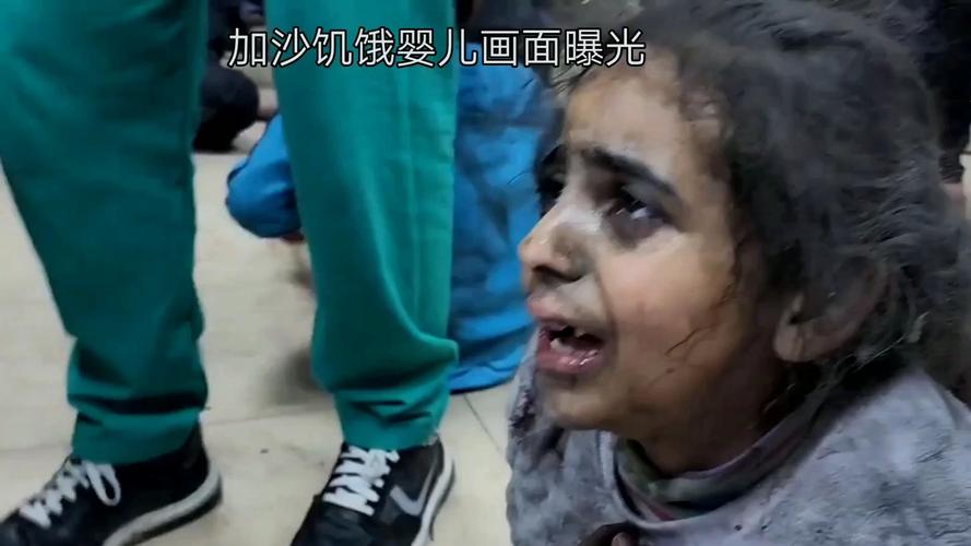 加沙儿童严重脱水 哭时没有一滴眼泪