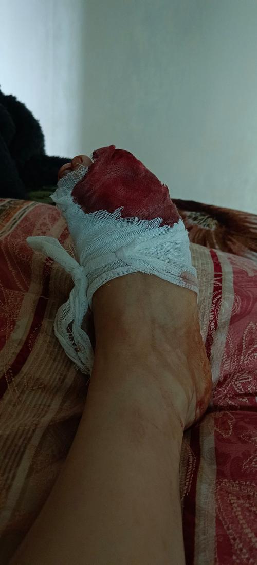 女子例假后游泳大出血向场馆索赔