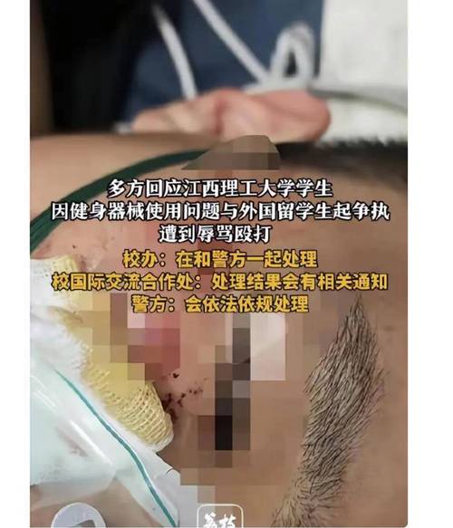 围殴中国留学生的嫌犯均被保释