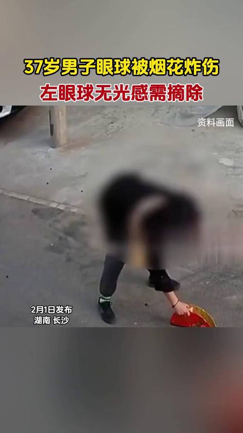 男子眼球遭炸伤，夏日常见物品隐患需警惕