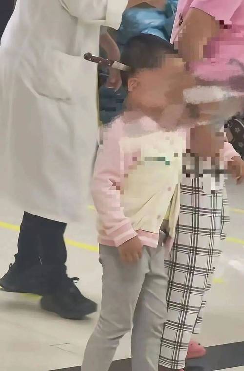 3岁女童头上插刀 系妈妈不慎刺入