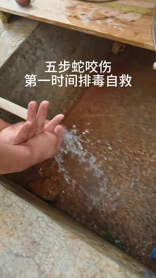 被蛇咬可以用嘴吸出毒血吗？