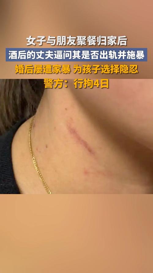 男子逼问妻子是否出轨并施暴，家庭暴力的警示