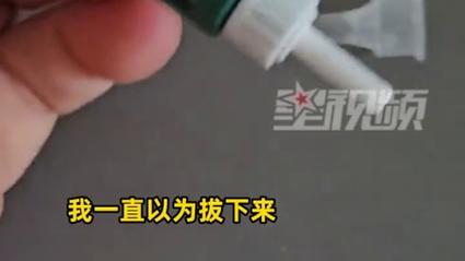 男子胰岛素注射后惊现针套遗漏一个月