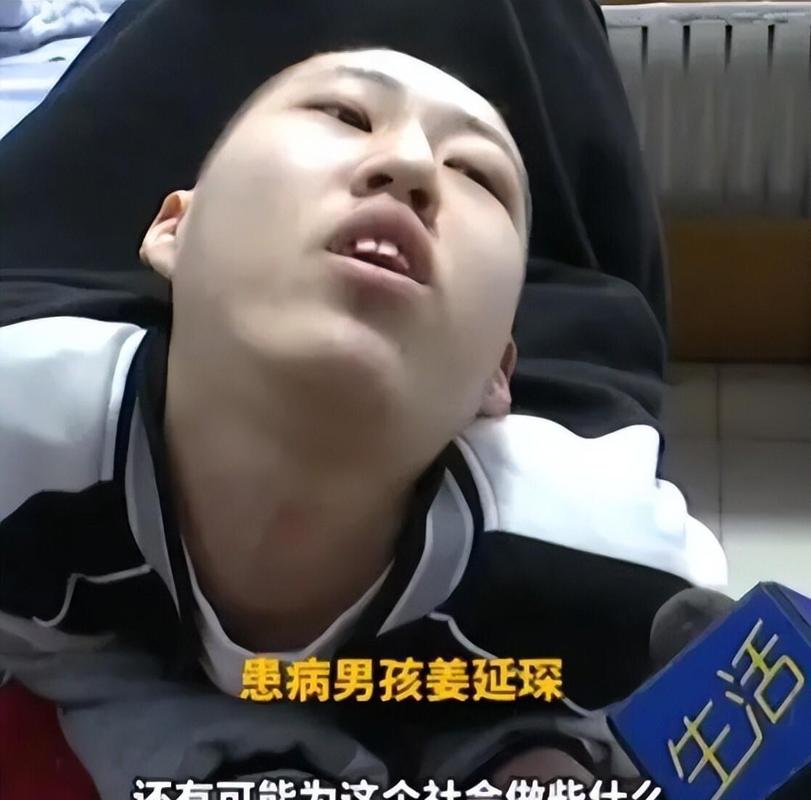 折叠男孩四次断骨重塑，迈出新生第一步