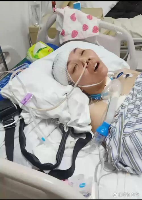 “身首离断”患者已转入普通病房