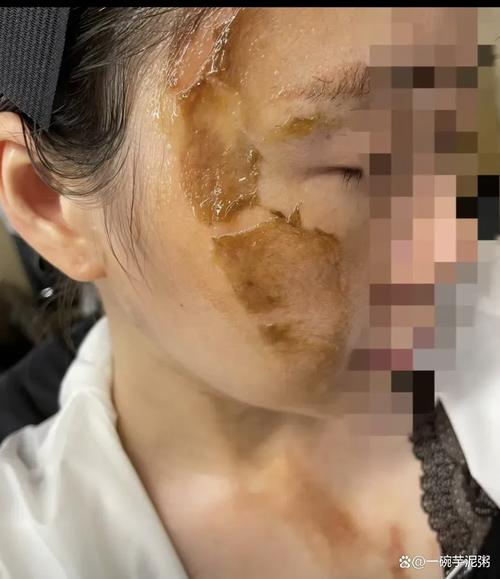 美国女子泼硫酸致丈夫死亡案庭审现场痛哭，丈夫离世引发社会关注