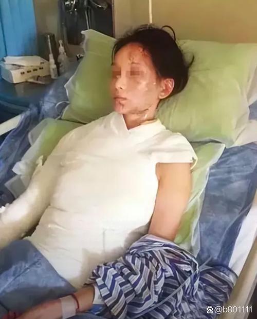 女子接触废弃氢氟酸致中毒身亡
