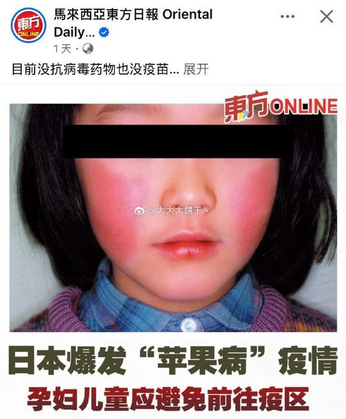 日本苹果病盛行至历史高峰