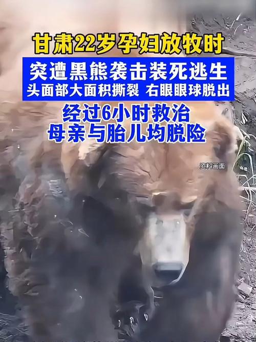 遭熊袭击孕妇发声:想尽全力保住孩子
