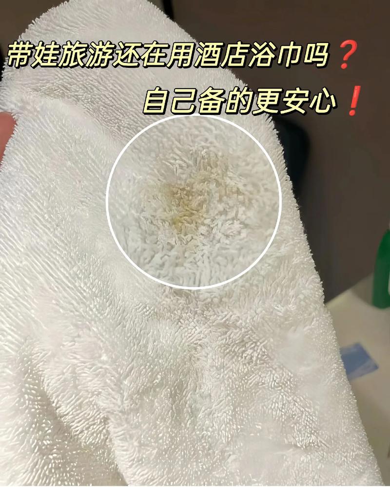 男子入住成都一酒店发现浴巾有血迹