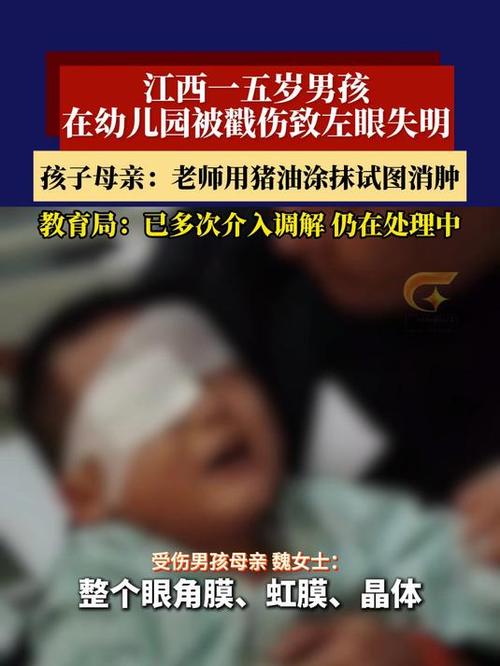 5岁男孩在幼儿园被戳伤致左眼失明