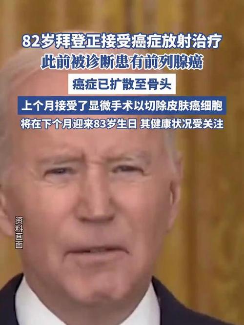 美国前总统拜登正接受癌症放射治疗