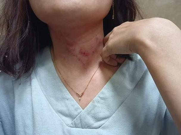 男子凌晨紧急救援，发现女子遭勒昏的惊险瞬间