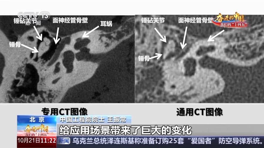 国产医疗装备利器不断涌现