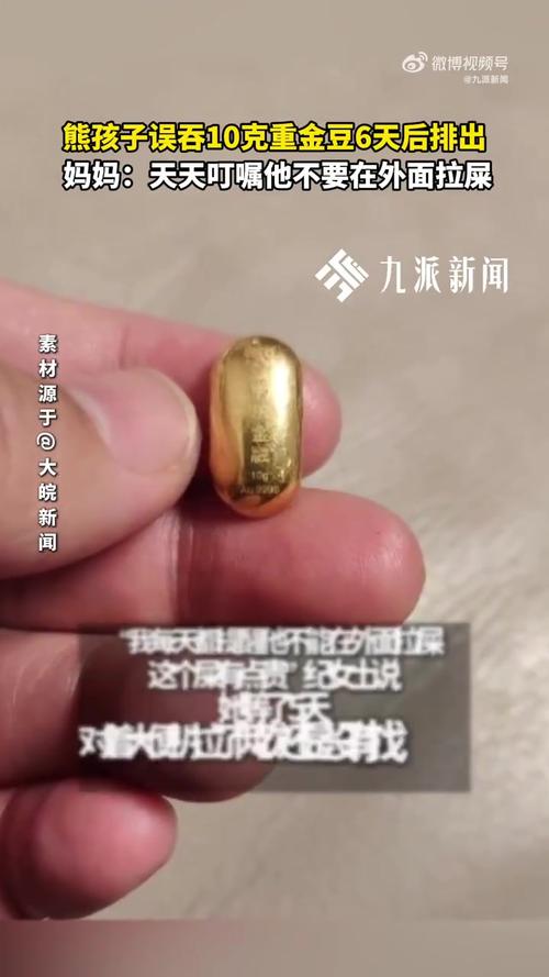 熊孩子误吞金豆后奇迹排出，医生揭示惊人经历