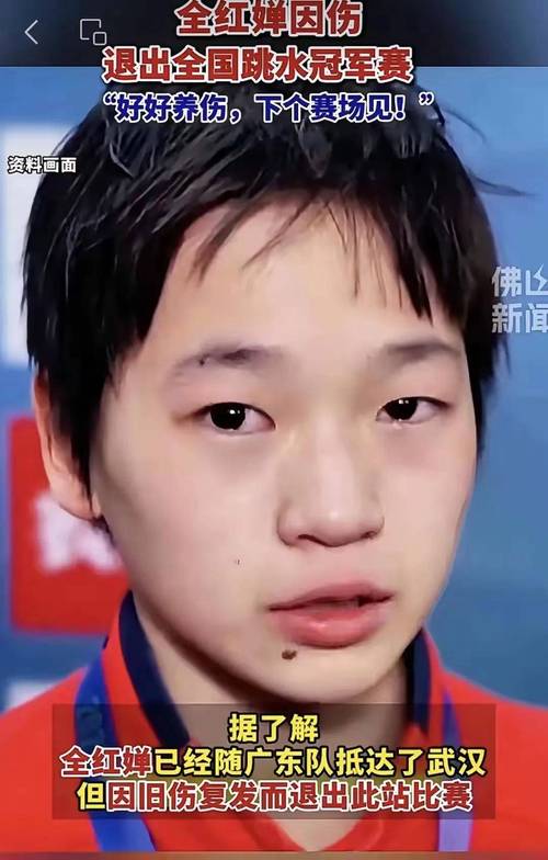 全红婵赛后回应伤情