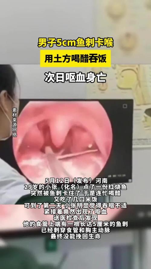 男子鱼刺卡喉身亡，工伤诉求遭驳回，事件解析与反思